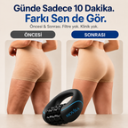 Movika BodyRoll™